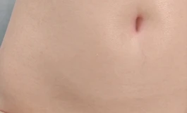 某小姐44斤腿模