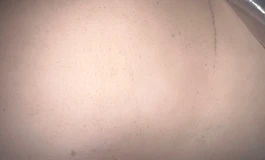 娃娃有霉点的救星